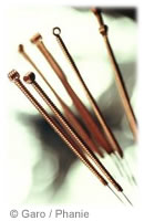 L'acupuncture